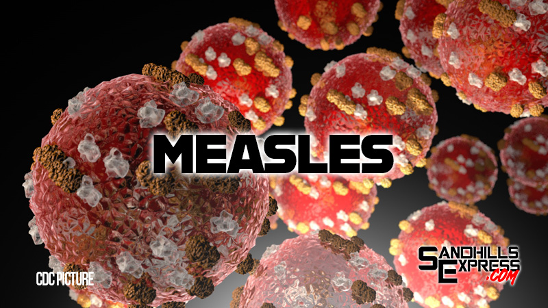 Confirmed measles case reported in Nebraska